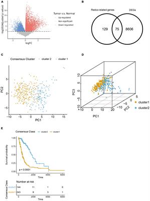 Impact of redox-related genes on tumor microenvironment immune characteristics and prognosis of high-grade gliomas